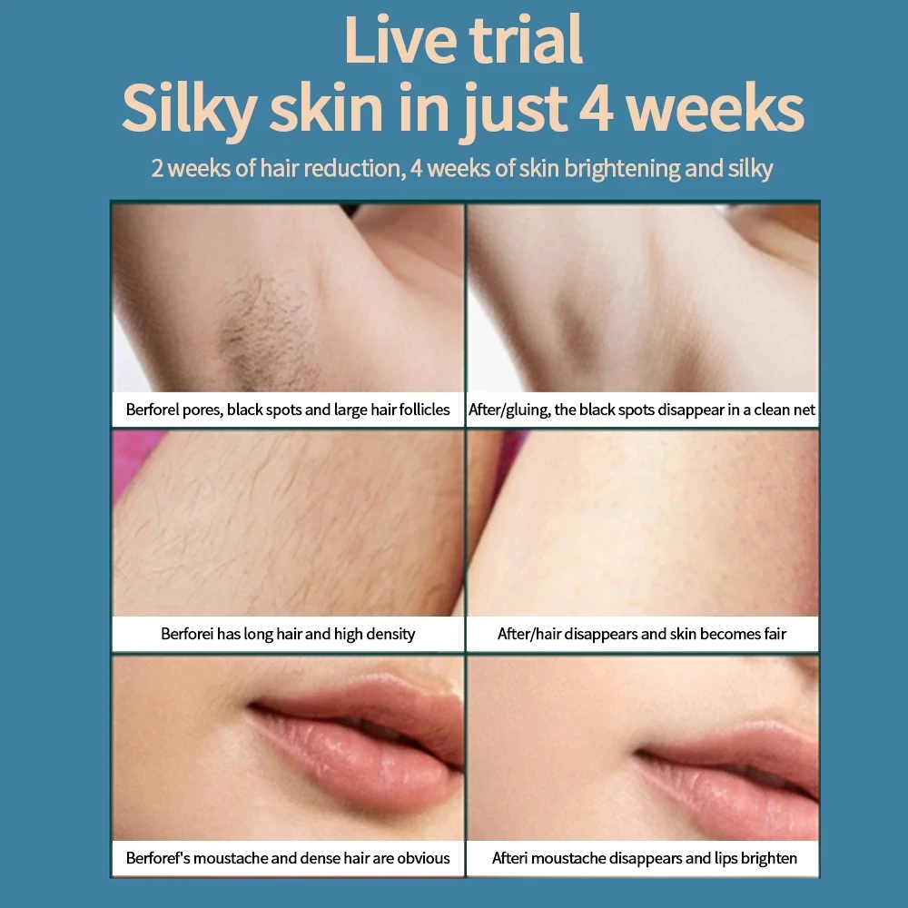 New Permanent Ipl Hair Removal Laser Armpit Hair Pemover Painless Electric Depilador 99999 Flashes IPL Epilator ipl machine new