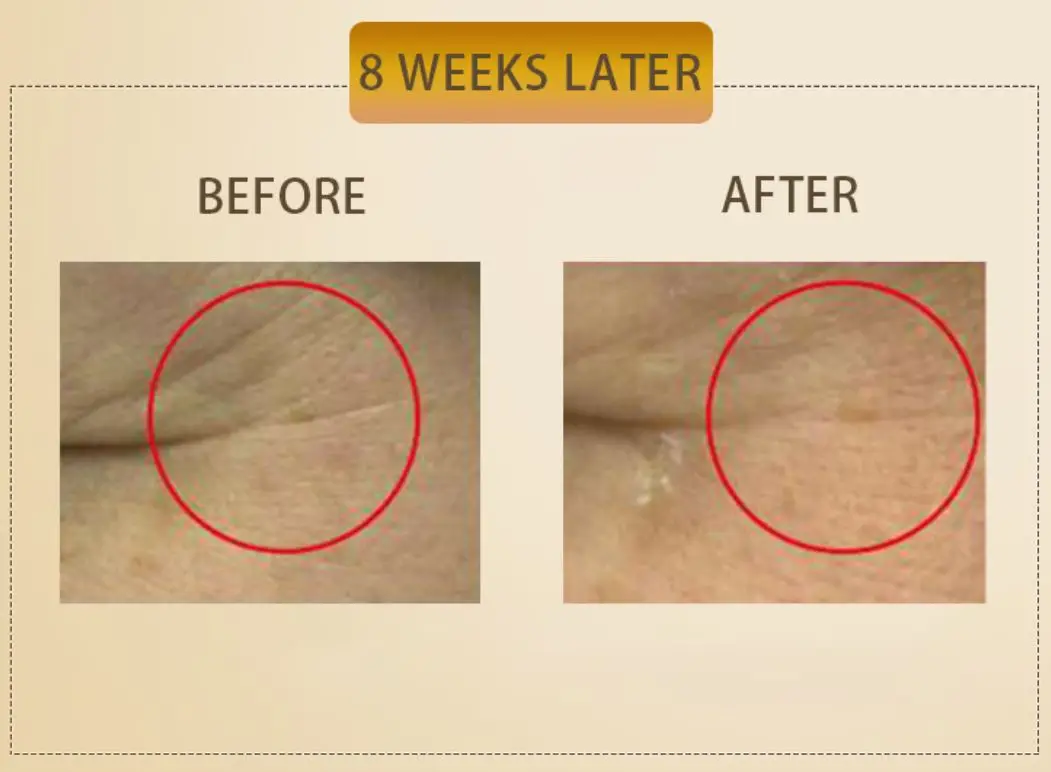 
improve the appearance of face skin care capsules 