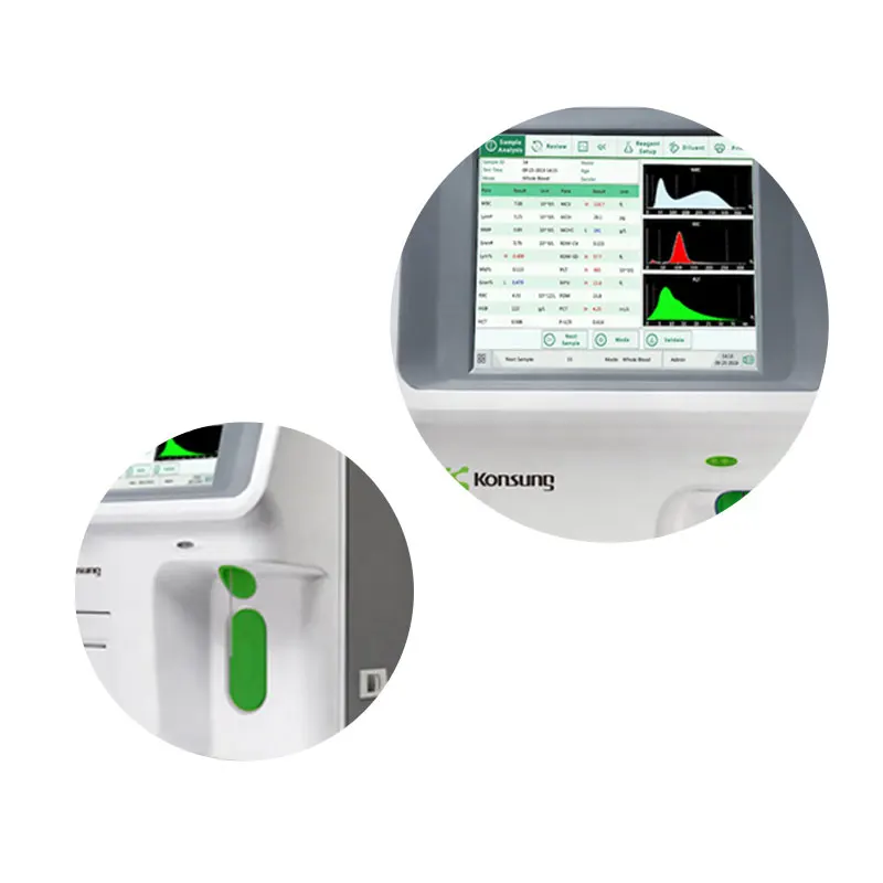 HA3 Open Reagent System Blood Analyzer automatic 3 diff hematology analyzer for hospital