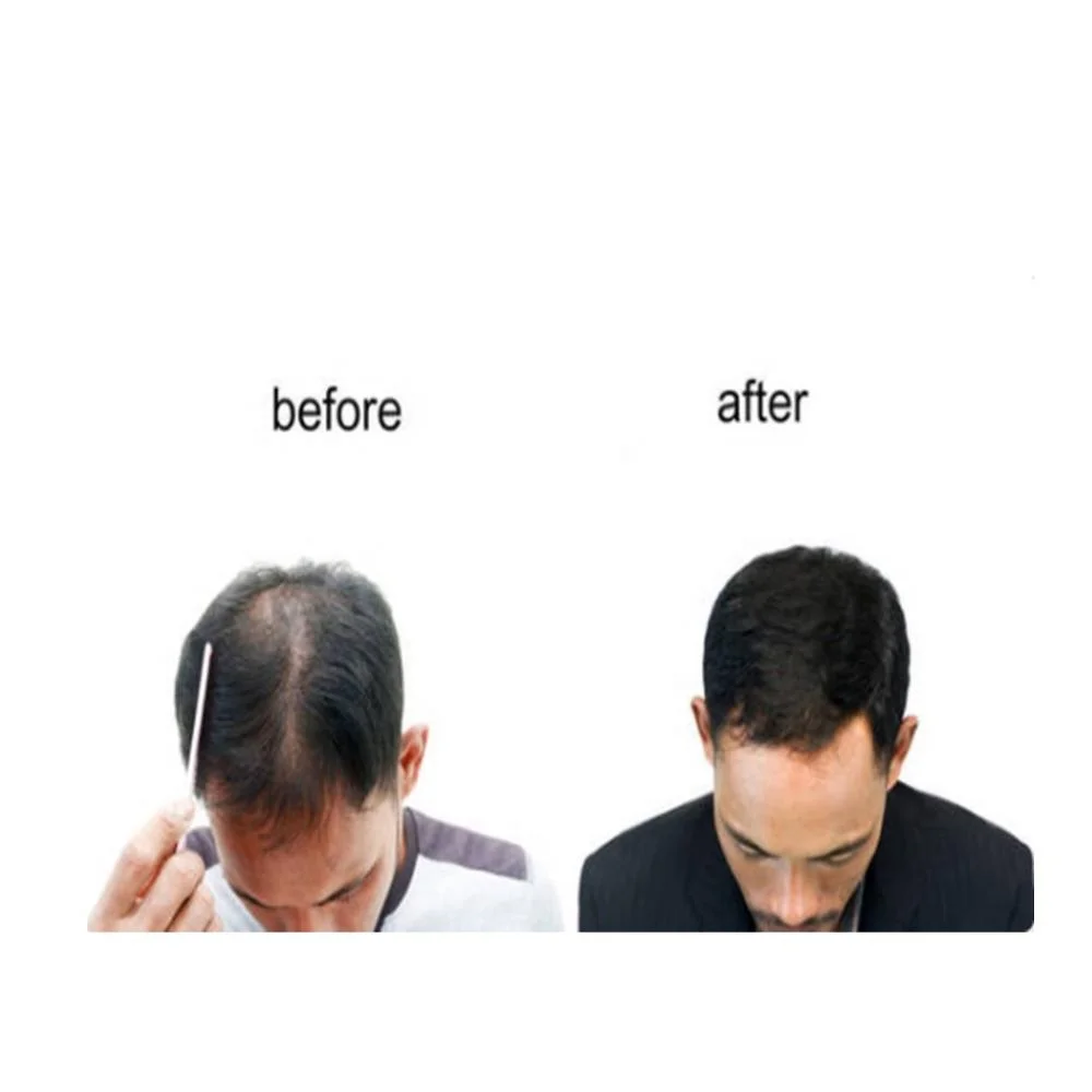 
natural hair growth serum for scalp refreshing 