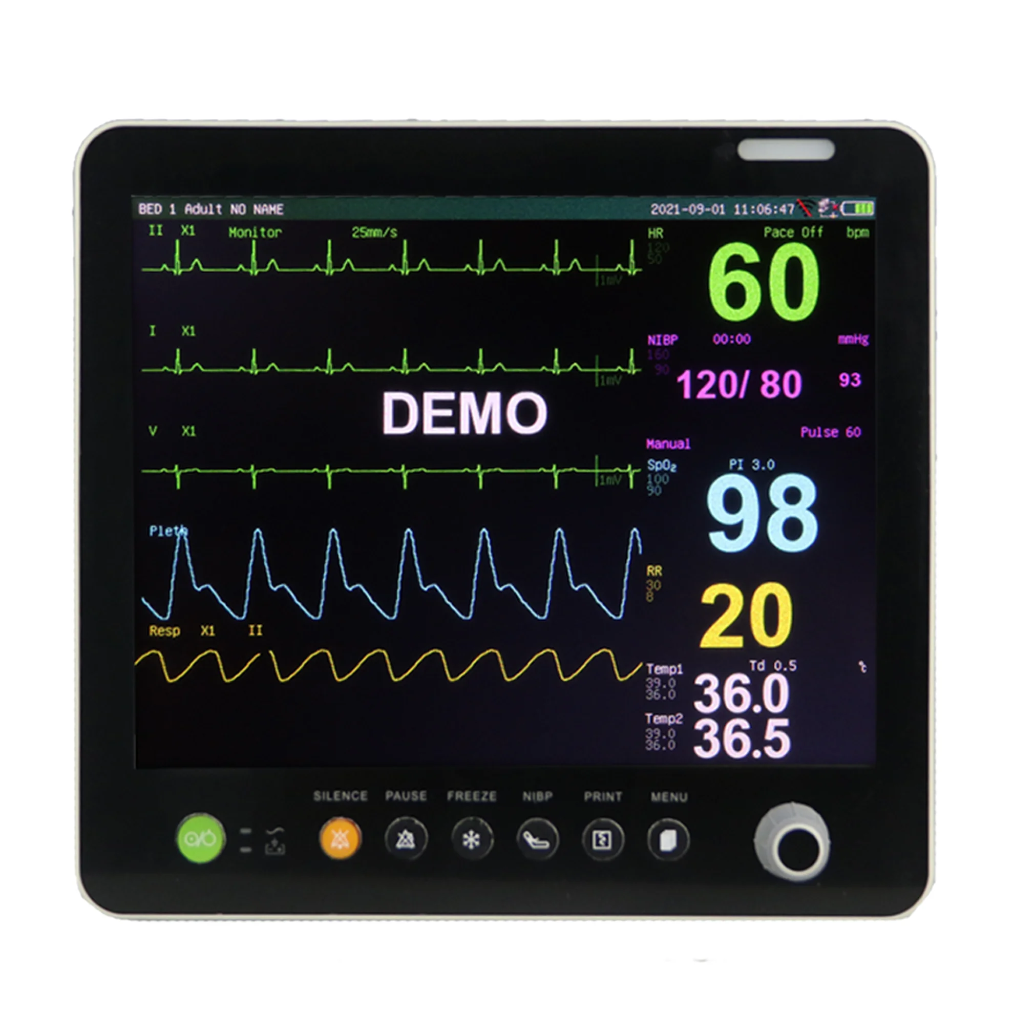 15 inch Touch Screen Medical Vital Monitor hospital equipment ambulance  6 Parameter  Patient Monitor For Icu