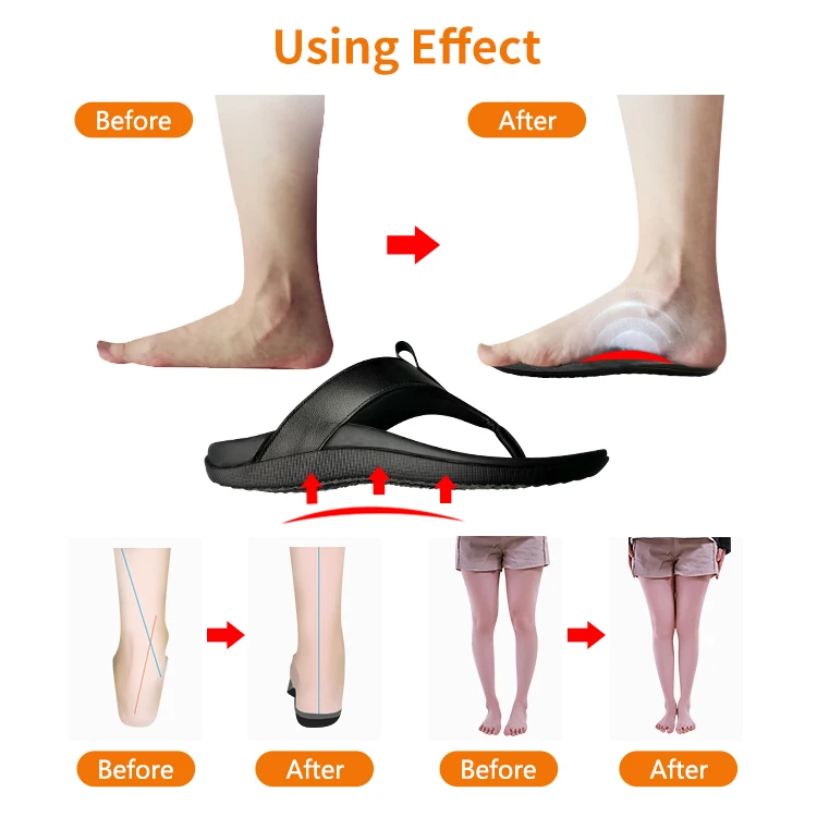Фабрика унисекс высокого качества для большого пальца стопы можно-помощник с открытым носком обувь коррекции осанки ортопедические