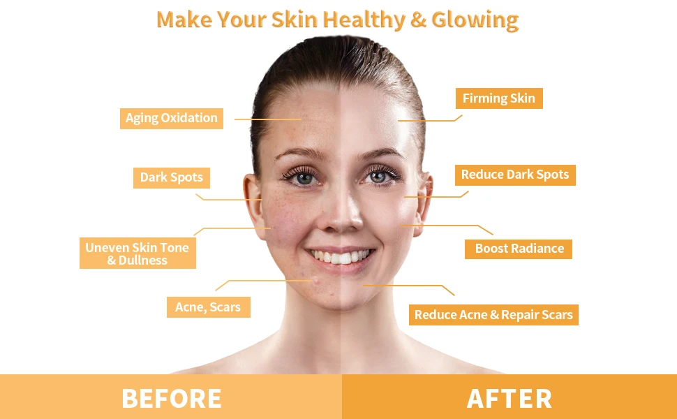 Turmeric Clay Maskss OEM/ODM Private Label Remove Anti Acne Whitening Hydrating Organic Turmeric Clay Facemask