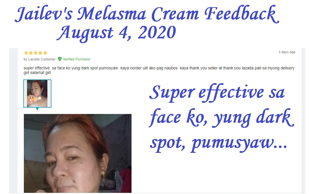 Anti Melasma Toner with AHA