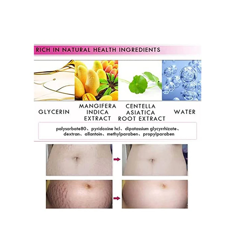 Glow It All Private Label Cocoa Butter Shea Plant Oils Organic Natural Mango Stretch Marks Removal Repair Cream