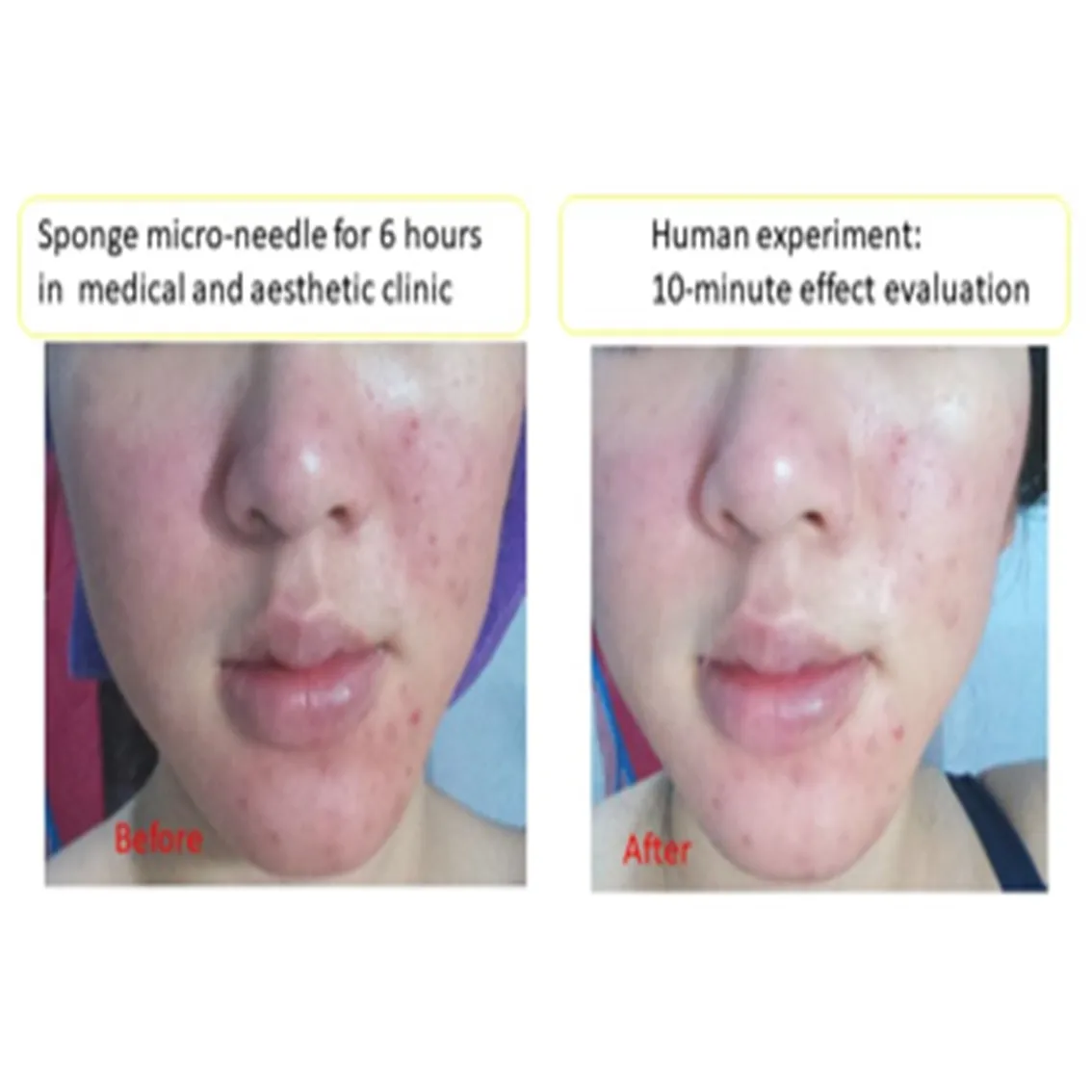 
Facial retinol anti aging Mask for skin care Moisturizing mask 