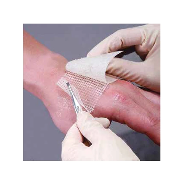 High Quality Wholesale Supply Non-adherent, Non allergenic 10cm X 10cm X 10cm Burn Paraffin Gauze Dressing