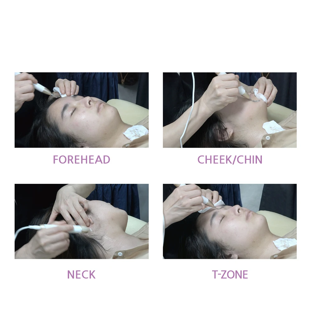 Korean High Technology skin rejuvenation exfoliation ultrasonic skin scrubber blackhead removal product dead skin removal