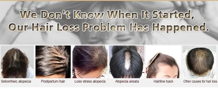 Custom Logo Hair Growth pure olive and coconut Serum Men Hair Regrowth Treatment Scalp Care Oils