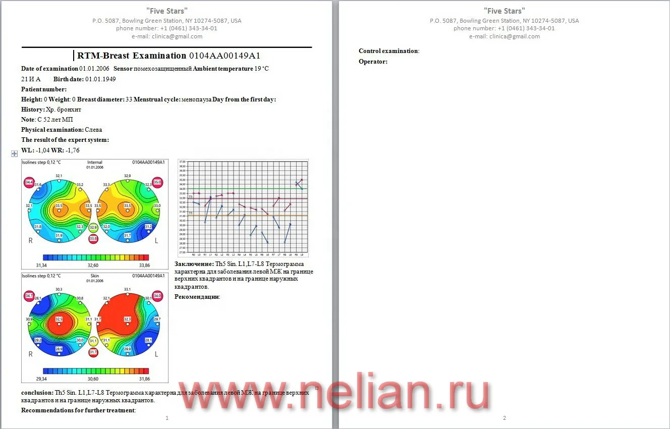  Медицинский всего тела термограф RTM-D2M раннего опухолей и диагностики рака оценки системы