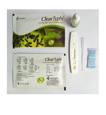 
typhoid igg/igm test 