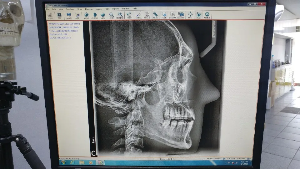 USED/REFURBISHED  DIGITAL CT & PANORAMIC DENTAL X-RAY SYSTEM w/wo CEPHALO UNIT